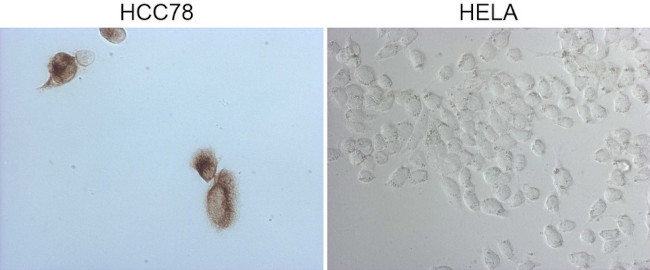 ROS1 Antibody in Immunocytochemistry (ICC/IF)