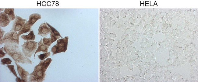 ROS1 Antibody in Immunocytochemistry (ICC/IF)