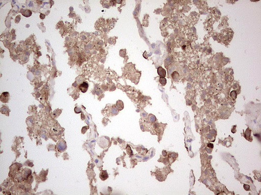 ROS1 Antibody in Immunohistochemistry (Paraffin) (IHC (P))