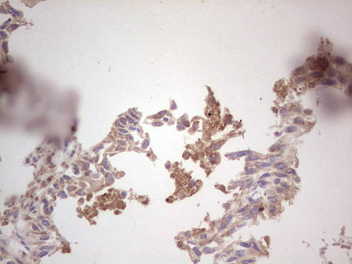 ROS1 Antibody in Immunohistochemistry (Paraffin) (IHC (P))