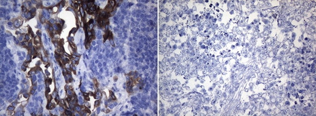 ROS1 Antibody in Immunohistochemistry (Paraffin) (IHC (P))