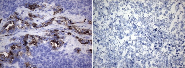 ROS1 Antibody in Immunohistochemistry (Paraffin) (IHC (P))