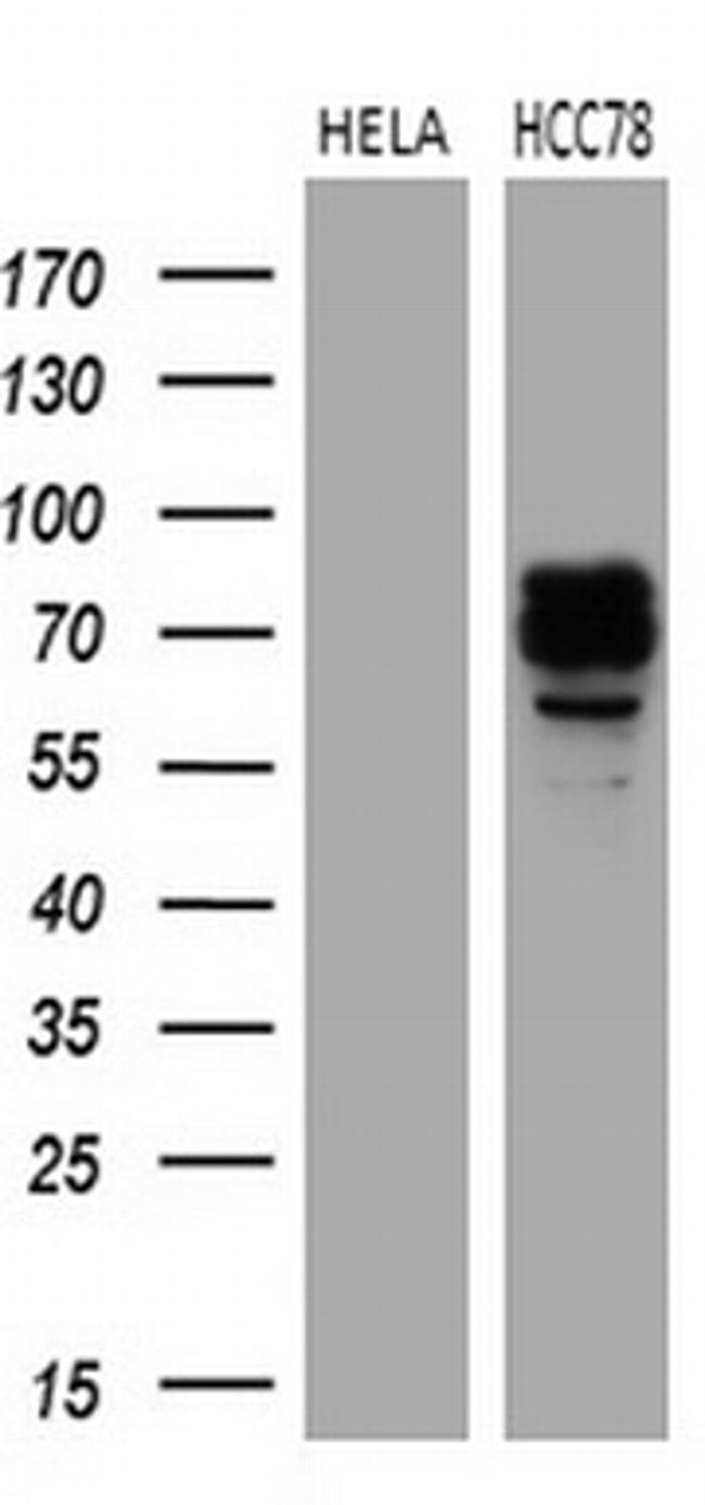 ROS1 Antibody in Western Blot (WB)