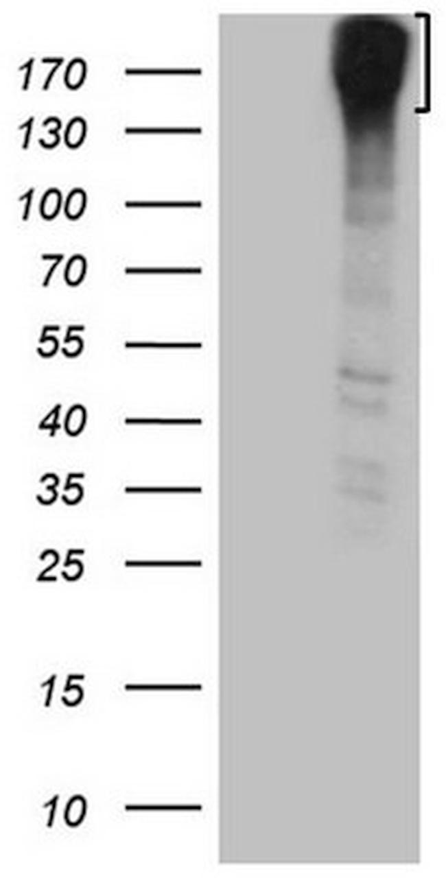 ROS1 Antibody in Western Blot (WB)