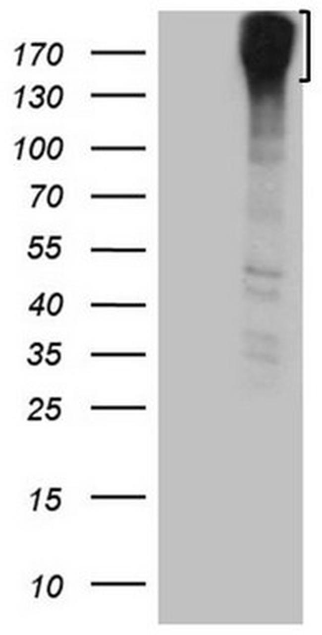 ROS1 Antibody in Western Blot (WB)