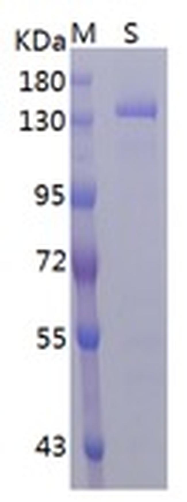 SARS-CoV-2 Spike Protein (S1/S2) (aa14-1213), His Tag Protein