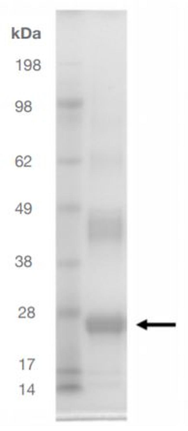 SARS-CoV-2 Spike Protein (RBD) (aa330-524), His Tag Protein