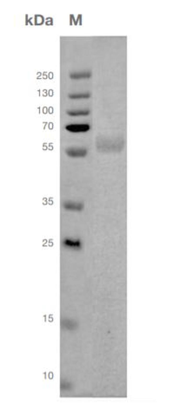 SARS-CoV-2 Nucleocapsid (aa1-419), His Tag Protein