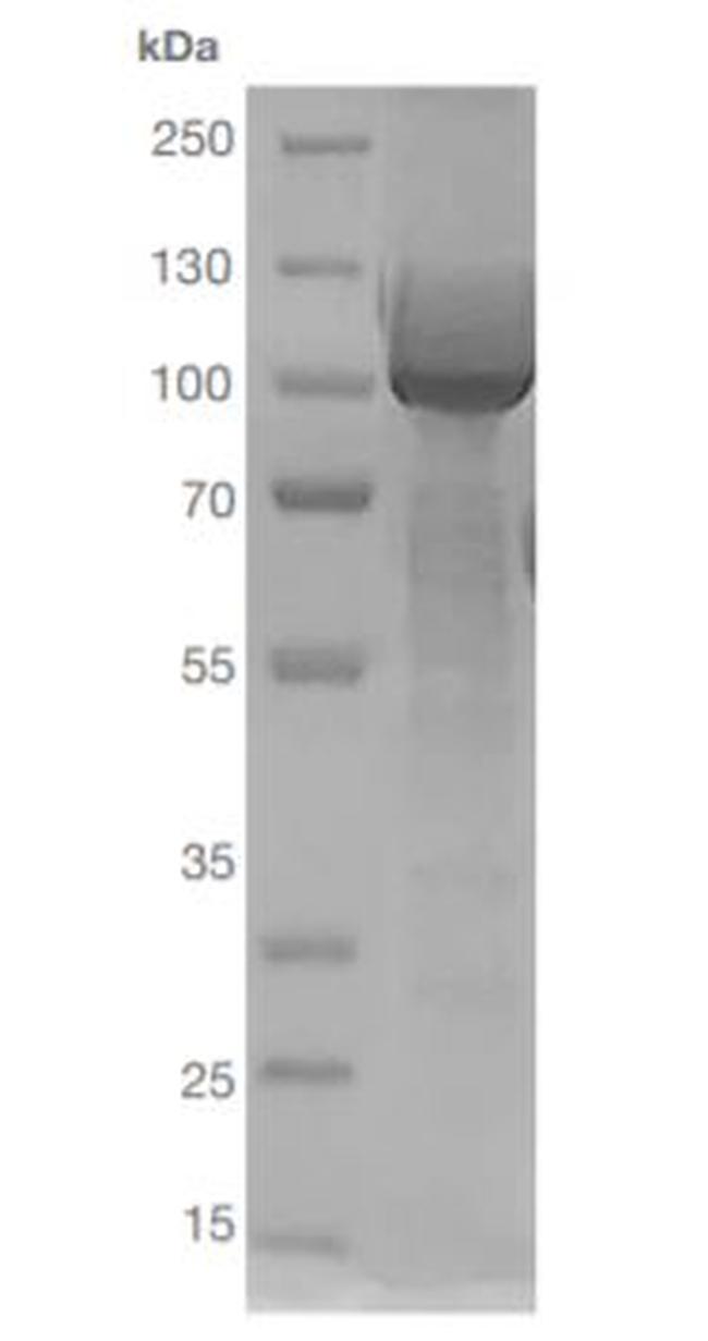 Human ACE2 (aa1-615) Fc Chimera Protein