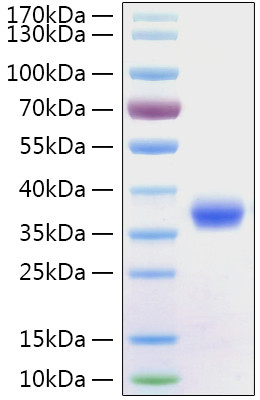 SARS-CoV-2 Spike Protein (RBD) (aa319-541), His Tag Protein in SDS-PAGE (SDS-PAGE)