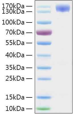 SARS-CoV-2 Spike Protein S1 (aa11-682), hFc-His Tag Protein in SDS-PAGE (SDS-PAGE)