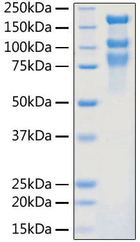 SARS-CoV-2 Spike Protein S1/S2 (aa11-1208), His Tag Protein in SDS-PAGE (SDS-PAGE)