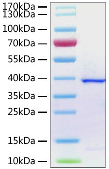 SARS-COV-2 ORF1a Polyprotein (aa1564-1878), His Tag Protein in SDS-PAGE (SDS-PAGE)