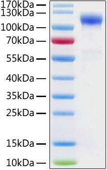 Human ACE2 (aa18-740), His-tag Protein in SDS-PAGE (SDS-PAGE)