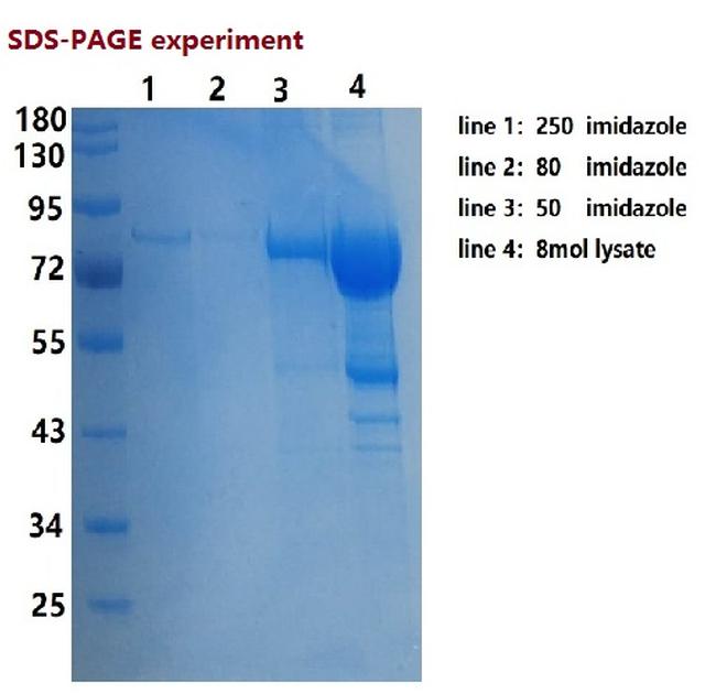 SARS-CoV-2 Nucleocapsid/Spike Protein (RBD) Protein