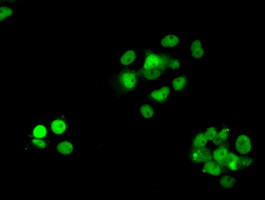 RPA2 Antibody in Immunocytochemistry (ICC/IF)