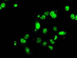 RPA2 Antibody in Immunocytochemistry (ICC/IF)