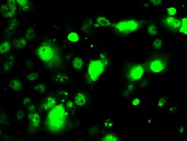 RPA2 Antibody in Immunocytochemistry (ICC/IF)