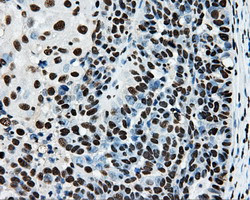 RPA2 Antibody in Immunohistochemistry (Paraffin) (IHC (P))