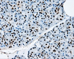 RPA2 Antibody in Immunohistochemistry (Paraffin) (IHC (P))