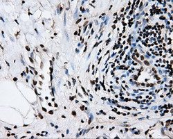 RPA2 Antibody in Immunohistochemistry (Paraffin) (IHC (P))