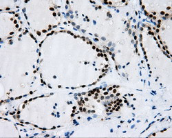 RPA2 Antibody in Immunohistochemistry (Paraffin) (IHC (P))