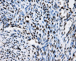 RPA2 Antibody in Immunohistochemistry (Paraffin) (IHC (P))