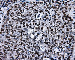 RPA2 Antibody in Immunohistochemistry (Paraffin) (IHC (P))