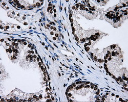 RPA2 Antibody in Immunohistochemistry (Paraffin) (IHC (P))