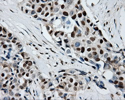 RPA2 Antibody in Immunohistochemistry (Paraffin) (IHC (P))