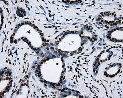 RPA2 Antibody in Immunohistochemistry (Paraffin) (IHC (P))