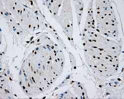 RPA2 Antibody in Immunohistochemistry (Paraffin) (IHC (P))