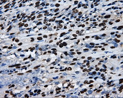 RPA2 Antibody in Immunohistochemistry (Paraffin) (IHC (P))