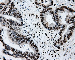 RPA2 Antibody in Immunohistochemistry (Paraffin) (IHC (P))