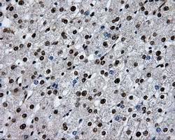 RPA2 Antibody in Immunohistochemistry (Paraffin) (IHC (P))