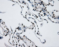 RPA2 Antibody in Immunohistochemistry (Paraffin) (IHC (P))