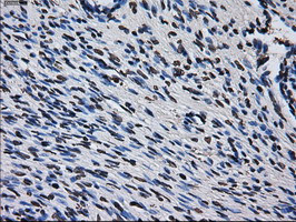 RPA2 Antibody in Immunohistochemistry (Paraffin) (IHC (P))