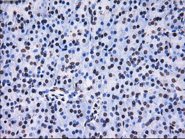 RPA2 Antibody in Immunohistochemistry (Paraffin) (IHC (P))