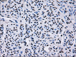 RPA2 Antibody in Immunohistochemistry (Paraffin) (IHC (P))