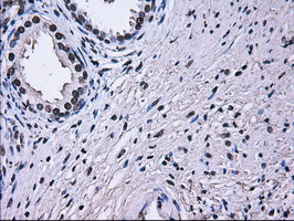 RPA2 Antibody in Immunohistochemistry (Paraffin) (IHC (P))