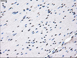 RPA2 Antibody in Immunohistochemistry (Paraffin) (IHC (P))