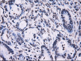 RPA2 Antibody in Immunohistochemistry (Paraffin) (IHC (P))