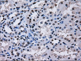 RPA2 Antibody in Immunohistochemistry (Paraffin) (IHC (P))