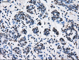 RPA2 Antibody in Immunohistochemistry (Paraffin) (IHC (P))