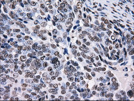 RPA2 Antibody in Immunohistochemistry (Paraffin) (IHC (P))