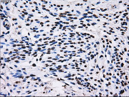 RPA2 Antibody in Immunohistochemistry (Paraffin) (IHC (P))