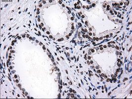 RPA2 Antibody in Immunohistochemistry (Paraffin) (IHC (P))