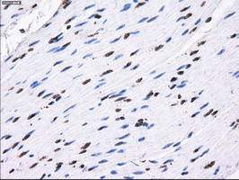 RPA2 Antibody in Immunohistochemistry (Paraffin) (IHC (P))