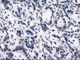 RPA2 Antibody in Immunohistochemistry (Paraffin) (IHC (P))