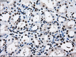 RPA2 Antibody in Immunohistochemistry (Paraffin) (IHC (P))